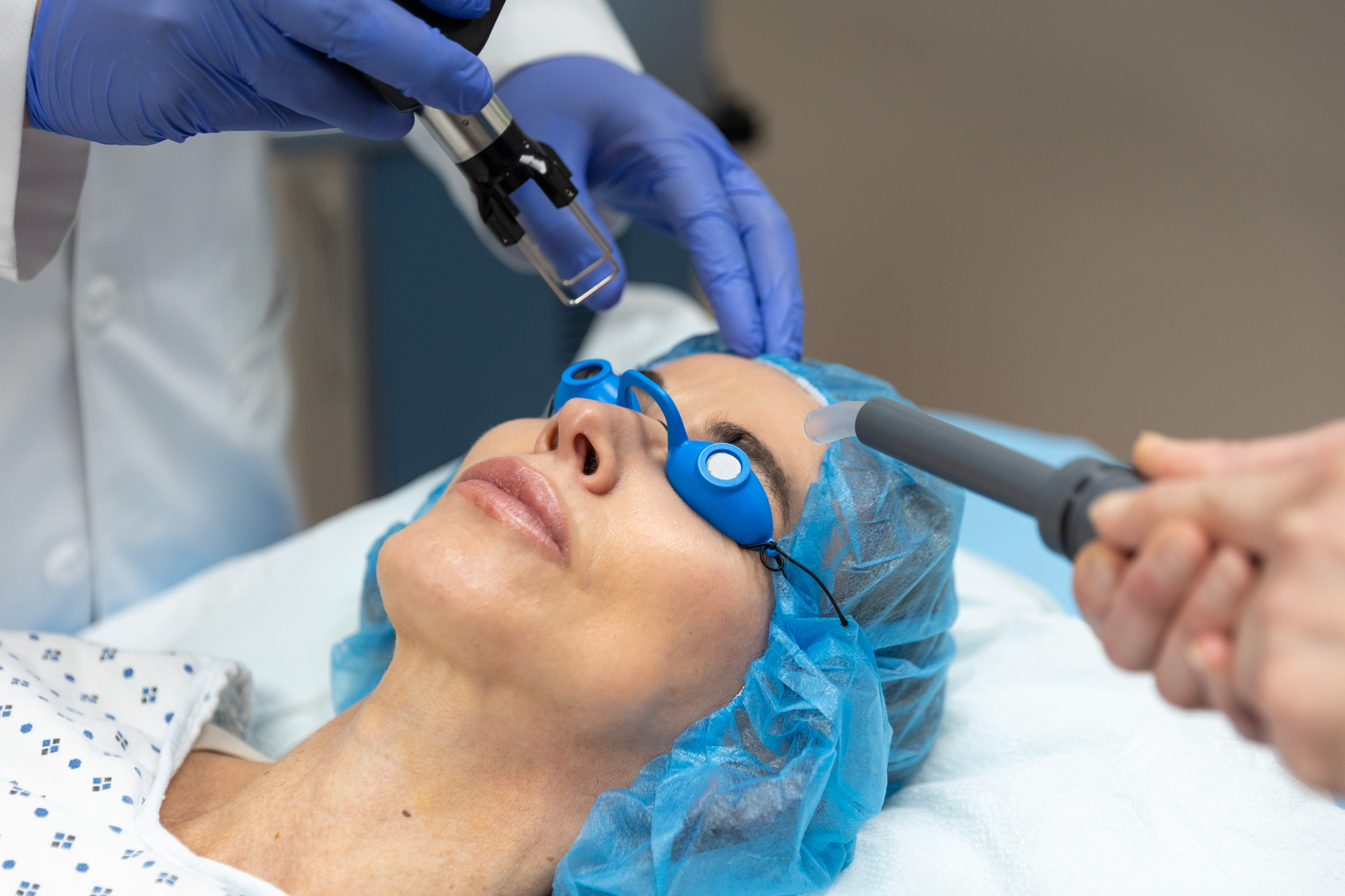 Patient receiving CO2 Laser Resurfacing on face by employees.