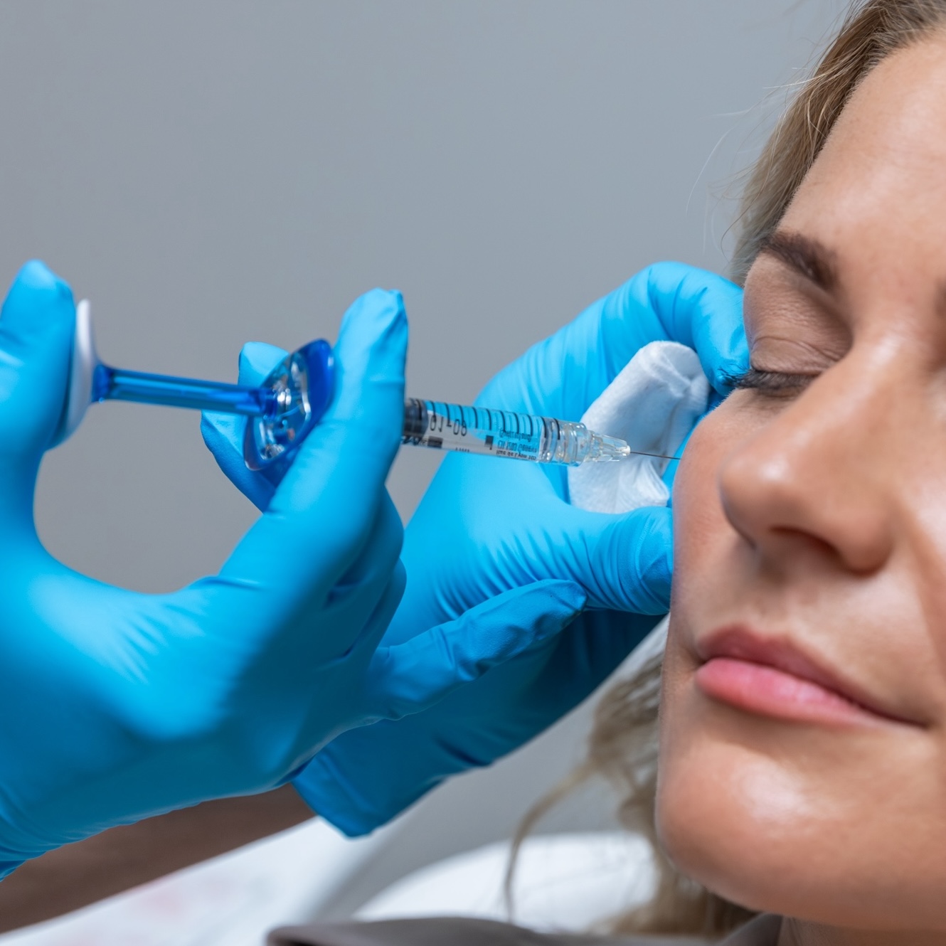 client receiving dermal fillers in cheek